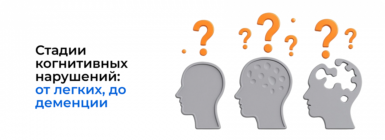 Стадии когнитивных нарушений: от легких, до деменции